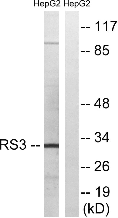 RPS3 / Ribosomal Protein S3 Antibody (aa171-220)