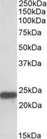 PathPlus™ SOD2 / Mn SOD Antibody (aa119-130)