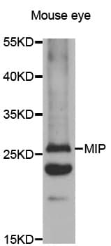 MIP / AQP0 / Aquaporin 0 Antibody