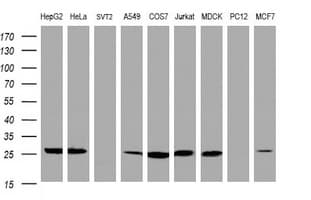 NQO2 Antibody (clone OTI3C11)