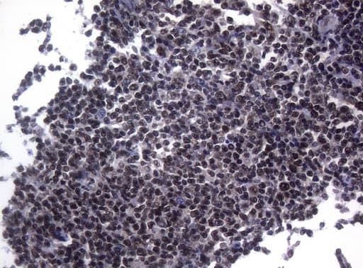 Monoclonal Mouse anti-Human SF1 Antibody (clone OTI7H9, aa1-276, IHC, WB)