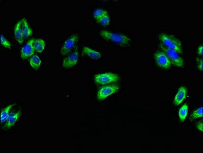 Polyclonal Rabbit anti-Human KIAA1840 / SPG11 Antibody
