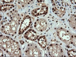 TRMT2A Antibody (clone OTI3D8, Carrier-free)