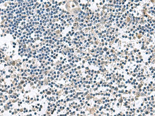 Polyclonal Rabbit anti-Human VEGFA / VEGF Antibody (IHC, WB)
