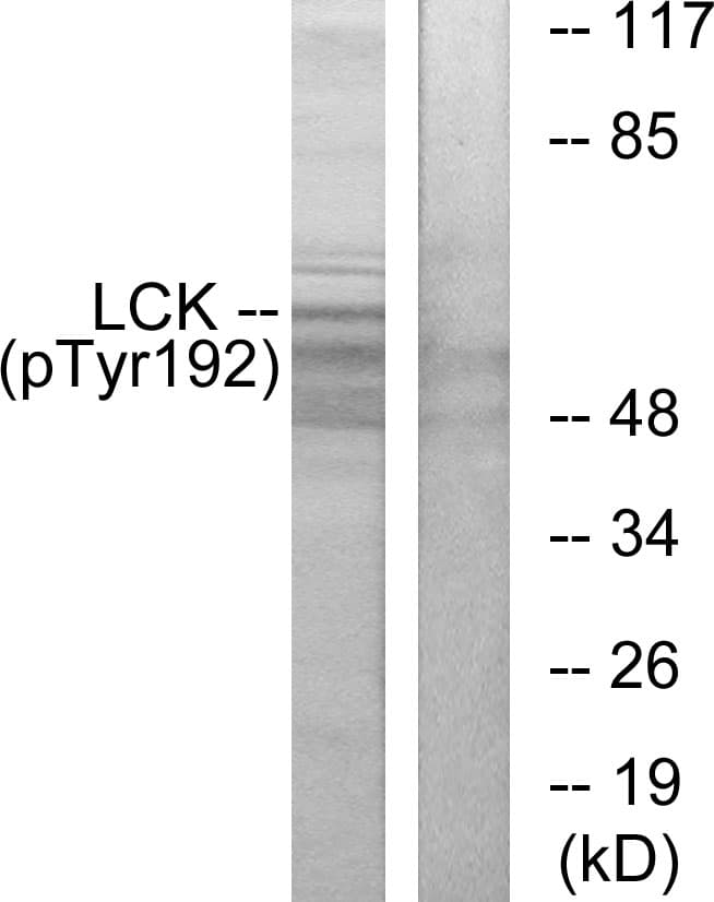 p56lck / LCK Antibody (phospho-Tyr192)