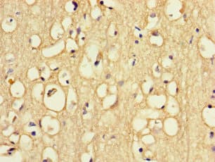 RFK Antibody