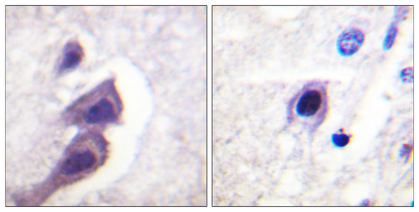 Tuberin / TSC2 Antibody (aa1428-1477)