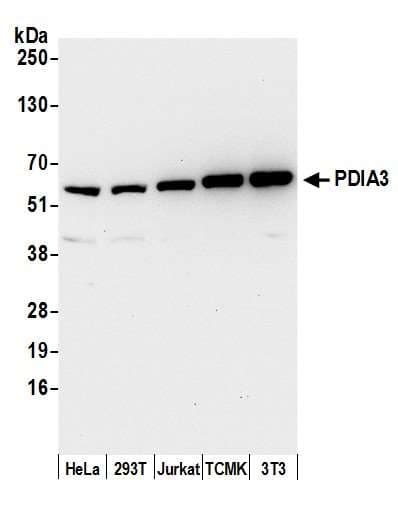 PDIA3 / ERp57 Antibody (aa50-100)