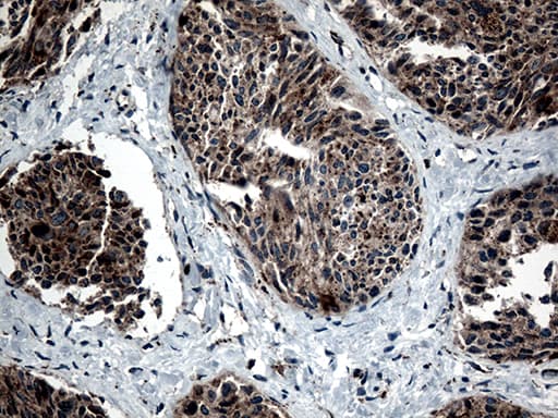 CTSL / Cathepsin L Antibody (aa114-333, clone OTI2C10)