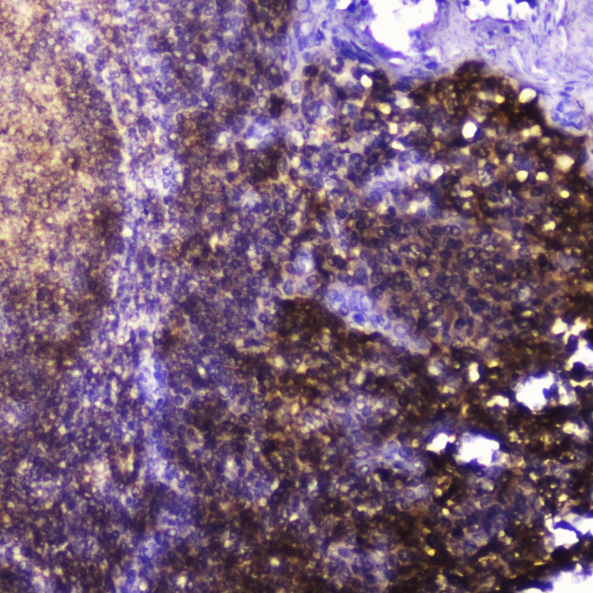 TLN1 / Talin 1 Antibody