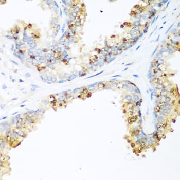 Polyclonal Rabbit anti-Human LRP5 Antibody (aa1000-1250, IHC, WB)