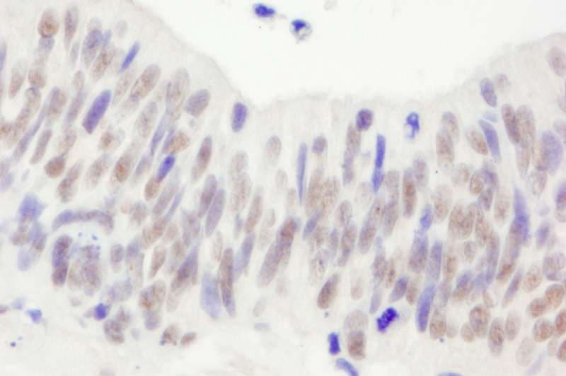 Polyclonal Rabbit anti-Human NBN / Nibrin Antibody (aa704-754, IHC, WB)
