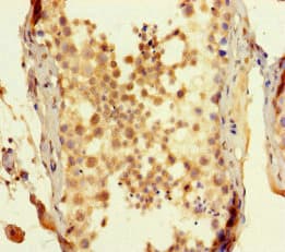 SPATA16 / NYD-SP12 Antibody