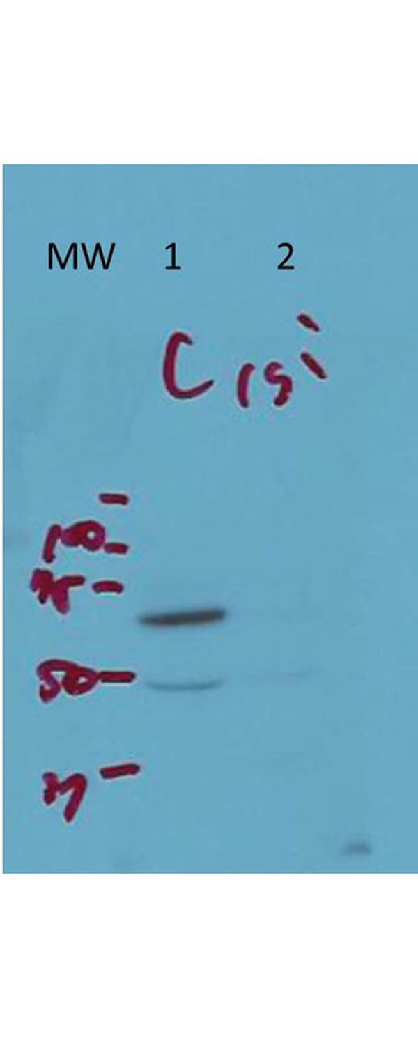Polyclonal Rabbit anti-Human ARFGAP3 Antibody (IF, WB)