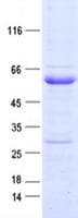 Human EPHB4 / EPH Receptor B4 Protein (Recombinant DDK,C-terminus)