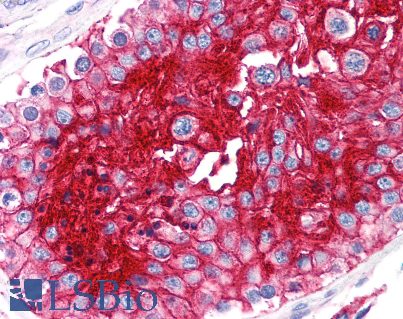 IHC-plus™ Monoclonal Mouse anti-Human Basigin / Emmprin / CD147 Antibody (clone MEM-M6/2, IHC)
