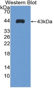 S100B / S100 Beta Antibody (aa1-92)