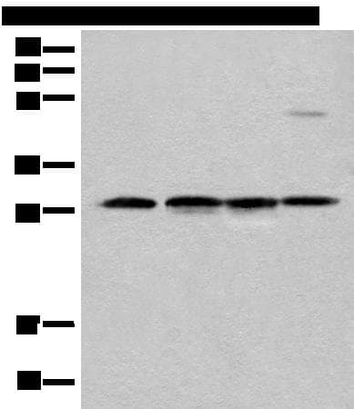 CA7 / Carbonic Anhydrase VII Antibody
