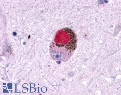 PathPlus™ GALR1 / Galanin Receptor 1 Antibody (N-Terminus)