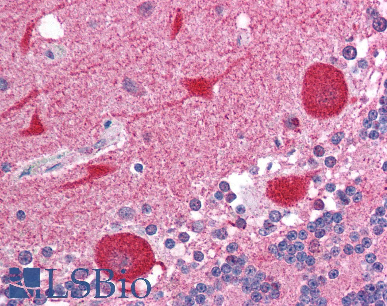 Polyclonal Rabbit anti-Human AKAP7 Antibody (N-Terminus, IHC, WB)