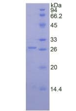 Mouse PRTN3 / Myeloblastin Protein (Recombinant 6His, N-terminus)
