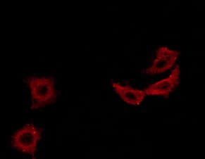 IRS1 Antibody (phospho-Ser307)