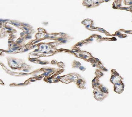 EFNA5 / Ephrin A5 Antibody