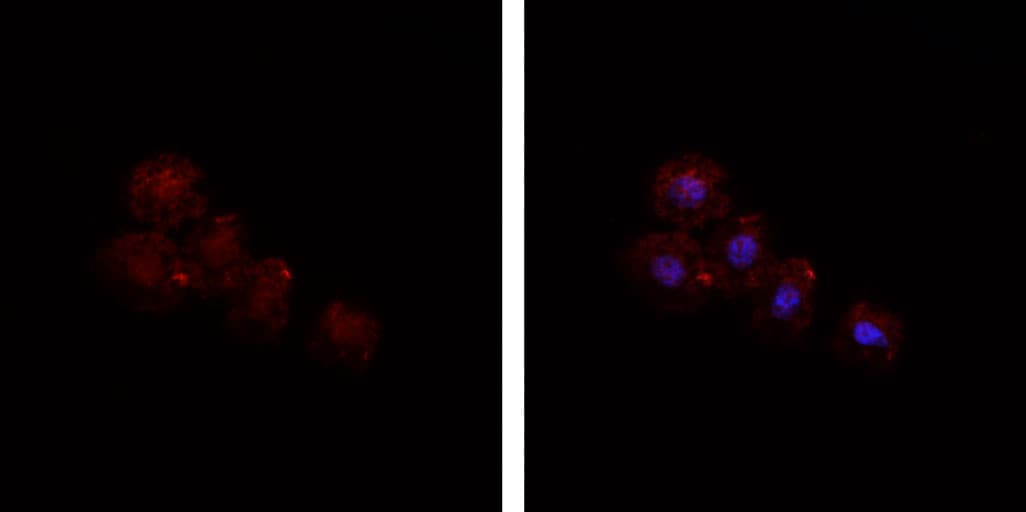 Polyclonal Rabbit anti-Human HSPA5 / GRP78 / BiP Antibody (IHC, IF, WB)