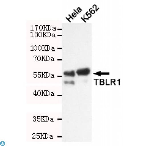 TBL1XR1 / TBLR1 Antibody