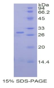 Human MOK / RAGE Protein (Recombinant His)