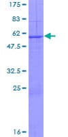 Human KLK13 / Kallikrein 13 Protein (Recombinant GST)