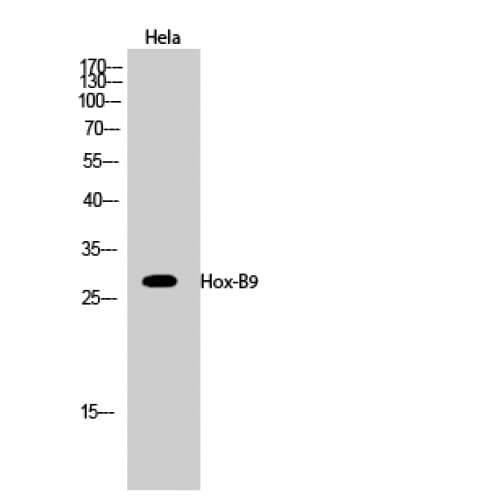 HOXB9 Antibody (180-260 aa, C-terminal)