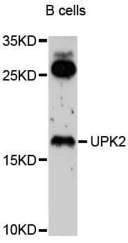 Polyclonal Rabbit anti-Human UPK2 / UPII / Uroplakin 2 Antibody (WB)