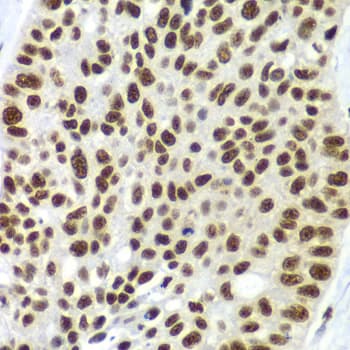 Polyclonal Rabbit anti-Human SF3B2 Antibody (IHC, IF, WB)
