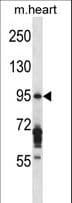 EXOC6B Antibody (aa767-796)
