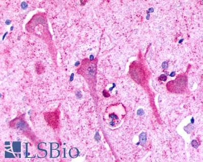 PathPlus™ Polyclonal Rabbit anti-Human P2RY8 / P2Y8 Antibody (Cytoplasmic Domain, IHC)
