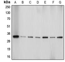 AQP4 / Aquaporin 4 Antibody (Internal)
