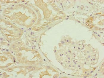 TRIM1 / MID2 Antibody