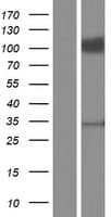 EMCN / Endomucin Protein (Over-Expression Lysate Myc-DDK (Flag))