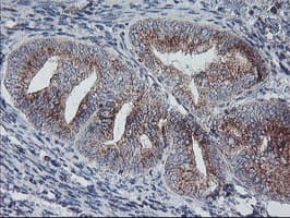 COPD / ARCN1 Antibody (clone OTI4H9)