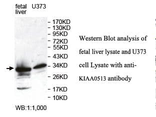 Polyclonal Rabbit anti-Human KIAA0513 Antibody (aa110-298, IHC, WB)