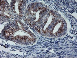 COPD / ARCN1 Antibody (clone OTI6A6)