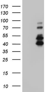 IRAK2 / IRAK-2 Antibody (aa362-625, clone OTI1D4)