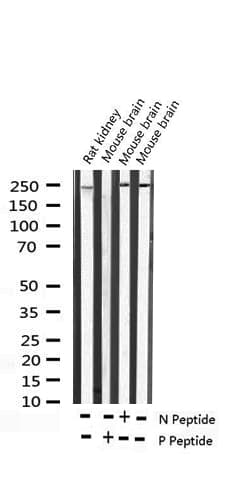 WNK1 Antibody (phospho-Thr58)