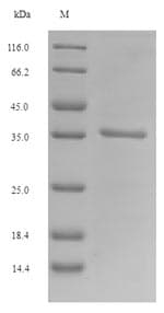 Mouse PLET1 / C11orf34 Protein (Recombinant 6His-SUMO, N-terminus)