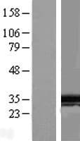 SPIN / SPIN1 Protein (Over-Expression Lysate Myc-DDK (Flag))