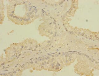 CCDC79 Antibody