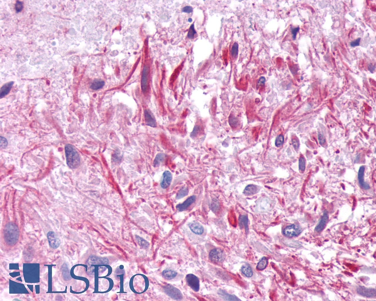 PathPlus™ GIPR / GIP Receptor Antibody (Cytoplasmic Domain)
