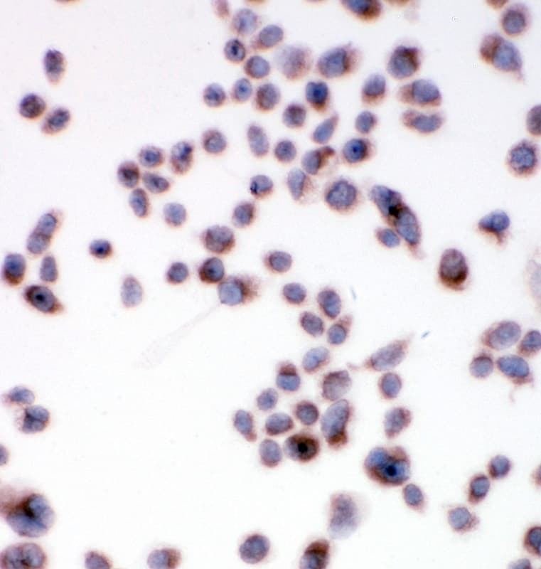 Polyclonal Rabbit anti-Human SSR3 / TRAP-Gamma Antibody (aa8-23, IHC, WB)