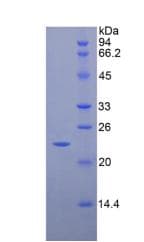 Rat CD8B / CD8 Beta Protein (Recombinant His)